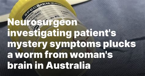 Neurosurgeon investigating patient’s mystery symptoms plucks a worm from woman’s brain in Australia
